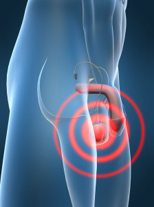 Low Secretion Levels in Men Photo