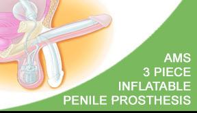 3 piece inflatable penile prosthesis image