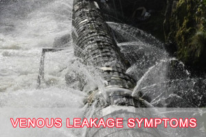 Venous Leakage Symptoms Image