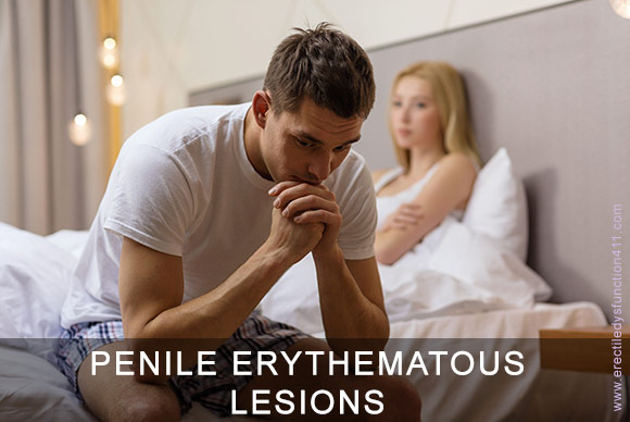 Penile Erythematous Lesions