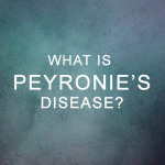 What is Peyronie’s Disease?