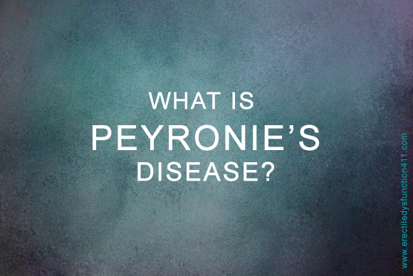 What is Peyronie’s Disease?