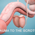 Trauma to the Scrotum
