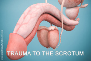 Trauma to the Scrotum Image